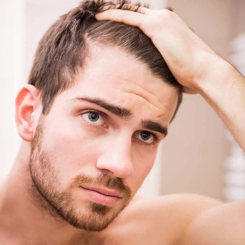 cách ngăn ngừa rụng tóc sớm ở nam giới